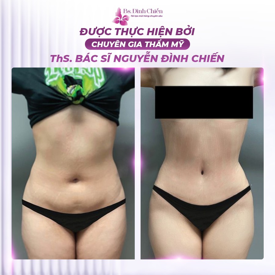 454400812 122108331692431032 7566466758916727066 n